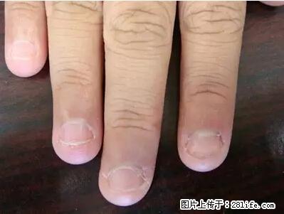 剪指甲、挖耳屎，这些日常小动作竟隐藏大危害！ - 黔南生活资讯 - 黔南28生活网 qn.28life.net